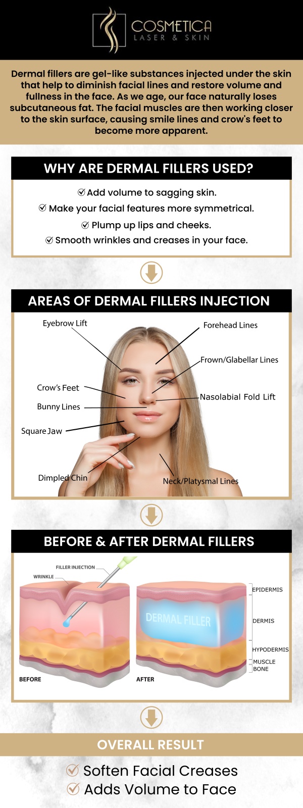Dermal fillers are injectable gels used to restore volume, smooth wrinkles, and enhance facial contours. Made from substances like hyaluronic acid, they can be used to plump lips, lift cheeks, fill in deep lines, and rejuvenate the under-eye area. The treatments are quick, offer immediate results, and provide a non-surgical way to achieve a more youthful and refreshed appearance. At Cosmetica Laser & Skin, our experienced professionals tailor each treatment to your unique needs, ensuring natural-looking results that enhance your facial features with minimal downtime. For more information, contact us or schedule an appointment online. We are conveniently located at 8225 Mid-Cities Blvd #300, North Richland Hills, TX 76182.