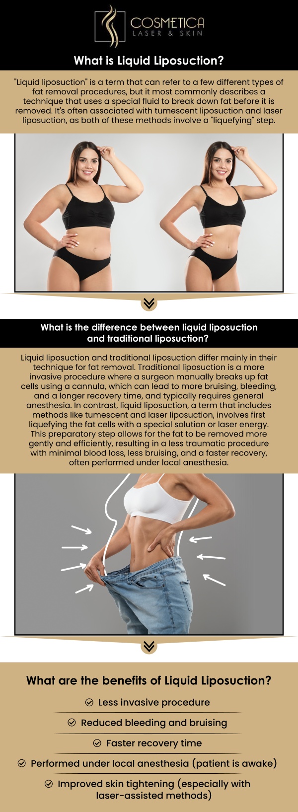 Liquid liposuction is a non-invasive body contouring treatment that targets stubborn fat areas to help sculpt and reshape the body without the need for traditional surgery. At Cosmetica Laser & Skin, our experienced team uses advanced techniques to reduce fat, providing noticeable results with minimal downtime. This safe and effective treatment can be customized to suit your individual needs, whether you're looking to target small areas of fat or achieve a more defined look. For more information, contact us or schedule an appointment online. We are conveniently located at 8225 Mid-Cities Blvd #300, North Richland Hills, TX 76182.